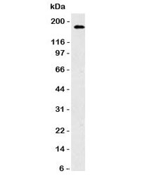 NCAM / CD56 Antibody - Western blot testing of HCT116 cell lysate and CD56 antibody. Observed molecular weights: 120, 140 and 180 kDa.  This image was taken for the unmodified form of this product. Other forms have not been tested.