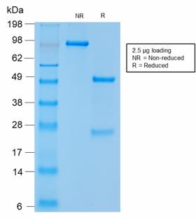 NCAM / CD56 Antibody - SDS-PAGE Analysis Purified CD56 Rabbit Recombinant Monoclonal Antibody (NCAM1/2217R). Confirmation of Purity and Integrity of Antibody.