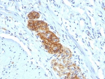 NCAM / CD56 Antibody - Formalin-fixed, paraffin-embedded human colon stained with NCAM antibody (NCAM1/784).  This image was taken for the unmodified form of this product. Other forms have not been tested.