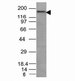 NCAM / CD56 Antibody - Western blot analysis of HCT116 cell lysate using CD56 antibody. Observed molecular weights: 120, 140 and 180 kDa.  This image was taken for the unmodified form of this product. Other forms have not been tested.