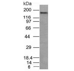 NCAM / CD56 Antibody - Western blot analysis of HCT116 cell lysate using CD56 antibody. Observed molecular weights: 120, 140 and 180 kDa.