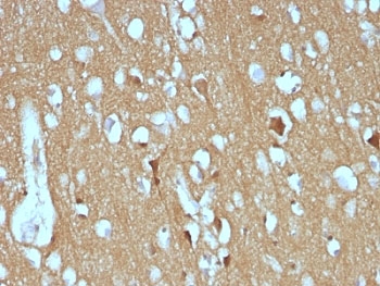 NCAM / CD56 Antibody - Formalin-fixed, paraffin-embedded human cerebellum stained with CD56 antibody (SPM128).  This image was taken for the unmodified form of this product. Other forms have not been tested.
