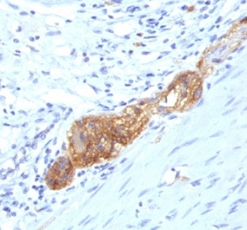 NCAM / CD56 Antibody - Formalin-fixed, paraffin-embedded human colon stained with anti-CD56 antibody (SPM489).  This image was taken for the unmodified form of this product. Other forms have not been tested.
