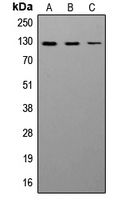 NCAM / CD56 Antibody - Western blot analysis of CD56 expression in SHSY5Y (A); K562 (B); mouse brain (C) whole cell lysates.