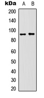 NCAM / CD56 Antibody - Western blot analysis of CD56 expression in mouse brain (A); mouse heart (B) whole cell lysates.