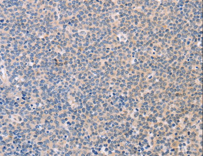 NCAM / CD56 Antibody - Immunohistochemistry of paraffin-embedded Human brain using NCAM1 Polyclonal Antibody at dilution of 1:30.
