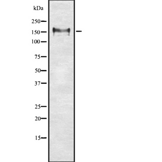 NCAM / CD56 Antibody - Western blot analysis of NCAM1 using RAW264.7 whole lysates