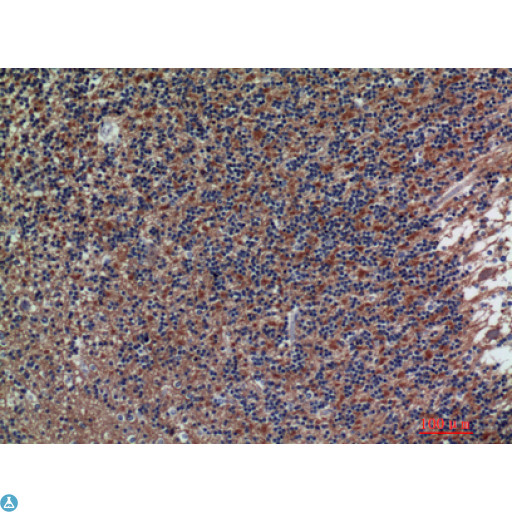 NCAM / CD56 Antibody - Western Blot (WB) analysis of Mouse Lung Mouse Heart lysis using NCAM1 antibody.