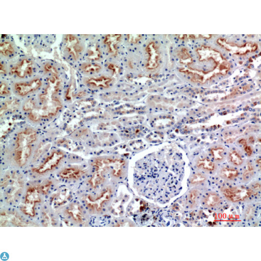 NCAM / CD56 Antibody - Western Blot (WB) analysis of HeLa cells using Antibody diluted at 1:1000.