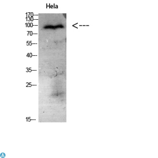 NCAM / CD56 Antibody - Immunohistochemistry (IHC) analysis of paraffin-embedded Human Kidney, antibody was diluted at 1:200.