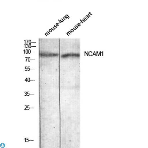 NCAM / CD56 Antibody - Immunohistochemistry (IHC) analysis of paraffin-embedded Human Brain, antibody was diluted at 1:200.