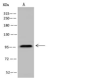 NCAM / CD56 Antibody - Anti-NCAM1 rabbit polyclonal antibody at 1:500 dilution. Lane A: Jurkat Whole Cell Lysate. Lysates/proteins at 30 ug per lane. Secondary: Goat Anti-Rabbit IgG (H+L)/HRP at 1/10000 dilution. Developed using the ECL technique. Performed under reducing conditions. Predicted band size: 94 kDa. Observed band size: 95 kDa.