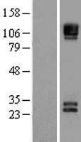 NCAM / CD56 Protein - Western validation with an anti-DDK antibody * L: Control HEK293 lysate R: Over-expression lysate
