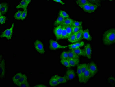 NCAM2 Antibody - Immunofluorescence staining of HepG2 cells with NCAM2 Antibody at 1:266, counter-stained with DAPI. The cells were fixed in 4% formaldehyde, permeabilized using 0.2% Triton X-100 and blocked in 10% normal Goat Serum. The cells were then incubated with the antibody overnight at 4°C. The secondary antibody was Alexa Fluor 488-congugated AffiniPure Goat Anti-Rabbit IgG(H+L).