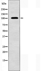 NCAM2 Antibody - Western blot analysis of extracts of MCF-7 cells using NCAM2 antibody.