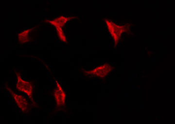 NCAM2 Antibody - Staining MCF-7 cells by IF/ICC. The samples were fixed with PFA and permeabilized in 0.1% Triton X-100, then blocked in 10% serum for 45 min at 25°C. The primary antibody was diluted at 1:200 and incubated with the sample for 1 hour at 37°C. An Alexa Fluor 594 conjugated goat anti-rabbit IgG (H+L) Ab, diluted at 1/600, was used as the secondary antibody.