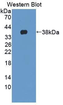 NCAN / Neurocan Antibody - Western blot of NCAN / Neurocan antibody.