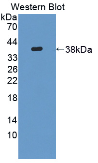 NCAN / Neurocan Antibody - Western blot of NCAN / Neurocan antibody.