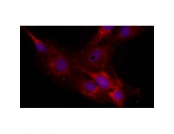 NCAN / Neurocan Antibody - Immunocytochemistry/ Immunofluorescence - Anti-Neurocan antibody [650.24] staining Neurocan in rat glioma cell line C6