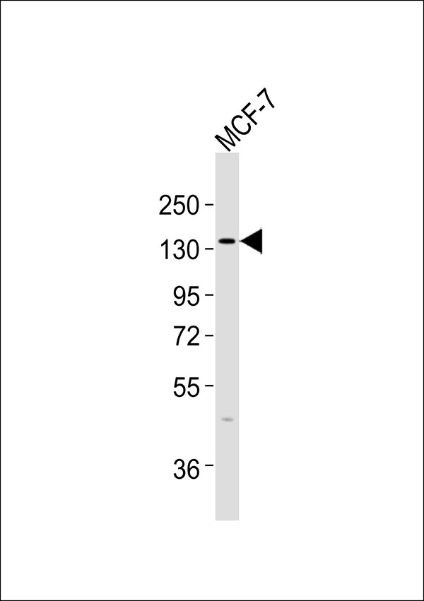 NCAN / Neurocan Antibody - Anti-Neurocan Antibody at 1:1000 dilution + MCF-7 whole cell lysates Lysates/proteins at 20 ug per lane. Secondary Goat Anti-Rabbit IgG, (H+L),Peroxidase conjugated at 1/10000 dilution Predicted band size : 143 kDa Blocking/Dilution buffer: 5% NFDM/TBST.