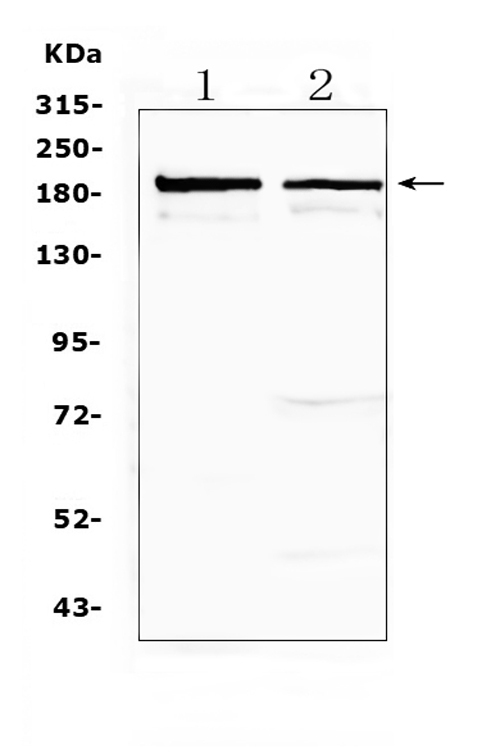NCAN / Neurocan Antibody - Western blot analysis of Neurocan using anti-Neurocan antibody. Electrophoresis was performed on a 5-20% SDS-PAGE gel at 70V (Stacking gel) / 90V (Resolving gel) for 2-3 hours. The sample well of each lane was loaded with 50ug of sample under reducing conditions. Lane 1: rat brain tissue lysates,Lane 2: rat testis tissue lysates. After Electrophoresis, proteins were transferred to a Nitrocellulose membrane at 150mA for 50-90 minutes. Blocked the membrane with 5% Non-fat Milk/ TBS for 1.5 hour at RT. The membrane was incubated with rabbit anti-Neurocan antigen affinity purified polyclonal antibody at 0.5 ug/mL overnight at 4?, then washed with TBS-0.1% Tween 3 times with 5 minutes each and probed with a goat anti-rabbit IgG-HRP secondary antibody at a dilution of 1:10000 for 1.5 hour at RT. The signal is developed using an Enhanced Chemiluminescent detection (ECL) kit with Tanon 5200 system. A specific band was detected for Neurocan at approximately 200KD. The expected band size for Neurocan is at 143KD.