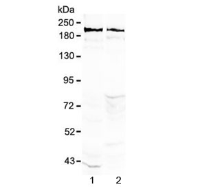 NCAN / Neurocan Antibody - Western blot tesing of rat 1) brain and 2) testis lysate with Neurocan antibody at 0.5ug/ml. Predicted molecular weight ~143 kDa (unmodified), up to ~250 kDa (fully glycosylated).