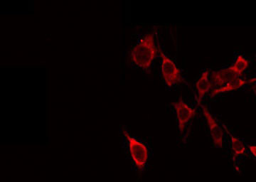 NCAN / Neurocan Antibody - Staining HeLa cells by IF/ICC. The samples were fixed with PFA and permeabilized in 0.1% Triton X-100, then blocked in 10% serum for 45 min at 25°C. The primary antibody was diluted at 1:200 and incubated with the sample for 1 hour at 37°C. An Alexa Fluor 594 conjugated goat anti-rabbit IgG (H+L) Ab, diluted at 1/600, was used as the secondary antibody.