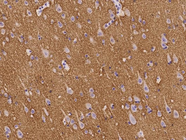 NCAN / Neurocan Antibody - Immunochemical staining of human NCAN in human brain with rabbit polyclonal antibody at 1:100 dilution, formalin-fixed paraffin embedded sections.