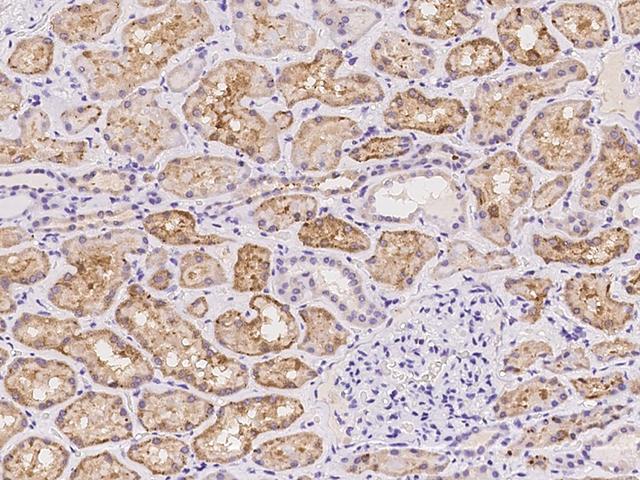 NCAN / Neurocan Antibody - Immunochemical staining of human NCAN in human kidney with rabbit polyclonal antibody at 1:100 dilution, formalin-fixed paraffin embedded sections.