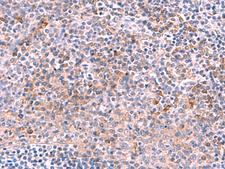 NCAN / Neurocan Antibody - Immunohistochemistry of paraffin-embedded Human tonsil tissue  using NCAN Polyclonal Antibody at dilution of 1:30(×200)