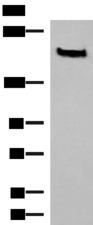 NCAN / Neurocan Antibody - Western blot analysis of Human cerebrum tissue lysate  using NCAN Polyclonal Antibody at dilution of 1:650