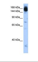 NCAPD2 Antibody - Jurkat cell lysate. Antibody concentration: 0.5 ug/ml. Gel concentration: 12%.  This image was taken for the unconjugated form of this product. Other forms have not been tested.