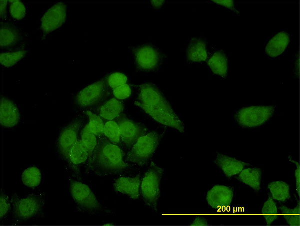 NCAPD2 Antibody - Immunofluorescence of monoclonal antibody to CNAP1 on HeLa cell. [antibody concentration 10 ug/ml]
