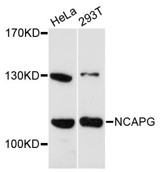 NCAPG / HCAP-G Antibody - Western blot analysis of extracts of various cell lines, using NCAPG antibody at 1:3000 dilution. The secondary antibody used was an HRP Goat Anti-Rabbit IgG (H+L) at 1:10000 dilution. Lysates were loaded 25ug per lane and 3% nonfat dry milk in TBST was used for blocking. An ECL Kit was used for detection and the exposure time was 90s.