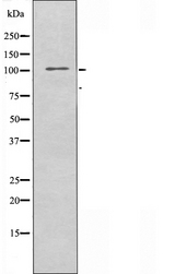 NCAPG / HCAP-G Antibody - Western blot analysis of extracts of HepG2 cells using NCAPG antibody.