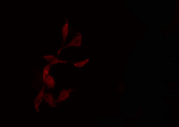 NCAPG / HCAP-G Antibody - Staining HepG2 cells by IF/ICC. The samples were fixed with PFA and permeabilized in 0.1% Triton X-100, then blocked in 10% serum for 45 min at 25°C. The primary antibody was diluted at 1:200 and incubated with the sample for 1 hour at 37°C. An Alexa Fluor 594 conjugated goat anti-rabbit IgG (H+L) antibody, diluted at 1/600, was used as secondary antibody.