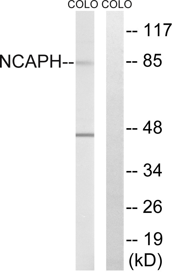 NCAPH / CAP-H Antibody - Western blot analysis of lysates from COLO cells, using NCAPH Antibody. The lane on the right is blocked with the synthesized peptide.