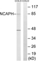 NCAPH / CAP-H Antibody - Western blot analysis of lysates from COLO cells, using NCAPH Antibody. The lane on the right is blocked with the synthesized peptide.