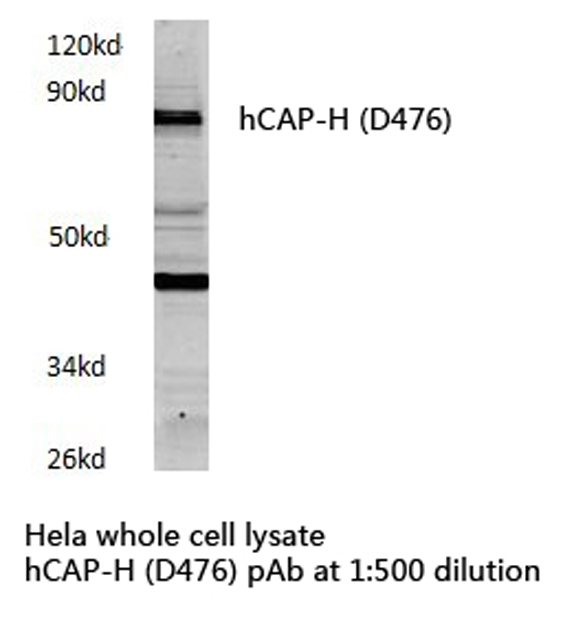 NCAPH / CAP-H Antibody - Western blot of hCAP-H (D476) pAb in extracts from HeLa cells.