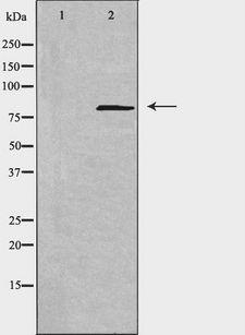 NCAPH / CAP-H Antibody - Western blot analysis of extracts of COLO cells using NCAPH antibody. The lane on the left is treated with the antigen-specific peptide.