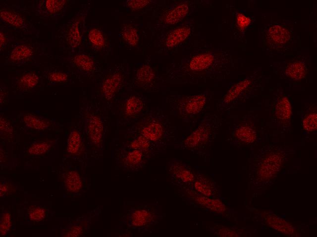 NCAPH / CAP-H Antibody - Immunofluorescence staining of NCAPH in U2OS cells. Cells were fixed with 4% PFA, permeabilzed with 0.1% Triton X-100 in PBS, blocked with 10% serum, and incubated with rabbit anti-Human NCAPH polyclonal antibody (dilution ratio 1:500) at 4°C overnight. Then cells were stained with the Alexa Fluor 594-conjugated Goat Anti-rabbit IgG secondary antibody (red). Positive staining was localized to Nucleus.