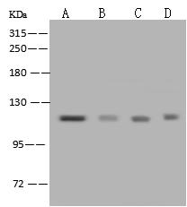 NCAPH / CAP-H Antibody - Anti-NCAPH rabbit polyclonal antibody at 1:500 dilution. Lane A: HeLa Whole Cell Lysate. Lane B: HepG2 Whole Cell Lysate. Lane C: Jurkat Whole Cell Lysate. Lane D: K562 Whole Cell Lysate. Lysates/proteins at 30 ug per lane. Secondary: Goat Anti-Rabbit IgG (H+L)/HRP at 1/10000 dilution. Developed using the ECL technique. Performed under reducing conditions. Predicted band size: 83 kDa.
