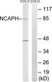 NCAPH / CAP-H Antibody - Western blot analysis of extracts from COLO cells, using NCAPH antibody.