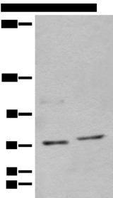 NCAPH / CAP-H Antibody - Western blot analysis of 562 and Jurkat cell lysates  using NCAPH Polyclonal Antibody at dilution of 1:450