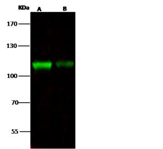 NCAPH / CAP-H Antibody - Anti-NCAPH rabbit polyclonal antibody at 1:500 dilution. Lane A: K562 Whole Cell Lysate. Lane B: HepG2 Whole Cell Lysate. Lysates/proteins at 30 ug per lane. Secondary: Goat Anti-Rabbit IgG H&L (Dylight 800) at 1/10000 dilution. Developed using the Odyssey technique. Performed under reducing conditions. Predicted band size: 82 kDa. Observed band size: 110 kDa.