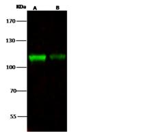 NCAPH / CAP-H Antibody - Anti-NCAPH rabbit polyclonal antibody at 1:500 dilution. Lane A: K562 Whole Cell Lysate. Lane B: HepG2 Whole Cell Lysate. Lysates/proteins at 30 ug per lane. Secondary: Goat Anti-Rabbit IgG H&L (Dylight 800) at 1/10000 dilution. Developed using the Odyssey technique. Performed under reducing conditions. Predicted band size: 82 kDa. Observed band size: 110 kDa.