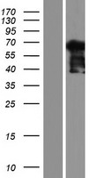 NCAPH2 / CAP-H2 Protein - Western validation with an anti-DDK antibody * L: Control HEK293 lysate R: Over-expression lysate