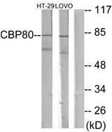 NCBP1 / CBP80 Antibody - Western blot analysis of lysates from HT-29 and LOVO cells, using NCBP1 Antibody. The lane on the right is blocked with the synthesized peptide.