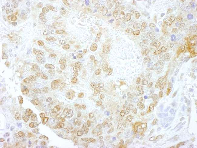 NCBP1 / CBP80 Antibody - Detection of Mouse NCBP1/CBP80 by Immunohistochemistry. Sample: FFPE section of mouse teratoma. Antibody: Affinity purified rabbit anti-NCBP1/CBP80 used at a dilution of 1:250.