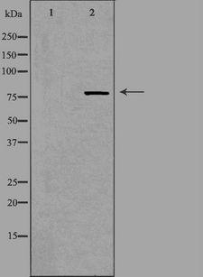 NCBP1 / CBP80 Antibody - Western blot analysis of extracts of HT29 cells using NCBP1 antibody. The lane on the left is treated with the antigen-specific peptide.